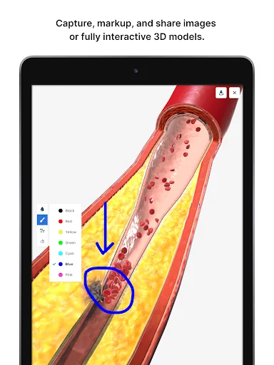 BioDigital Human ডাউনলোড করুন – সেরা 3D অ্যানাটমি লার্নিং অ্যাপ - Screenshot 11