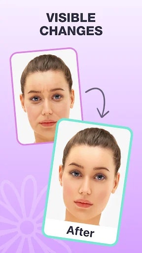 Face Yoga Exercise & Face Lift ডাউনলোড করুন – প্রাকৃতিক উপায়ে ত্বক সুন্দর করুন - Screenshot 11